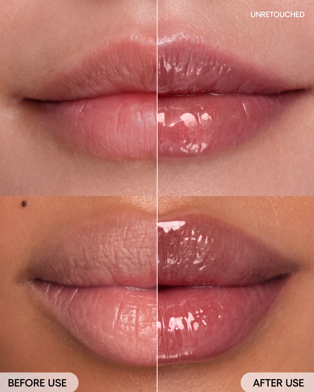 Peptide Lip Treatment