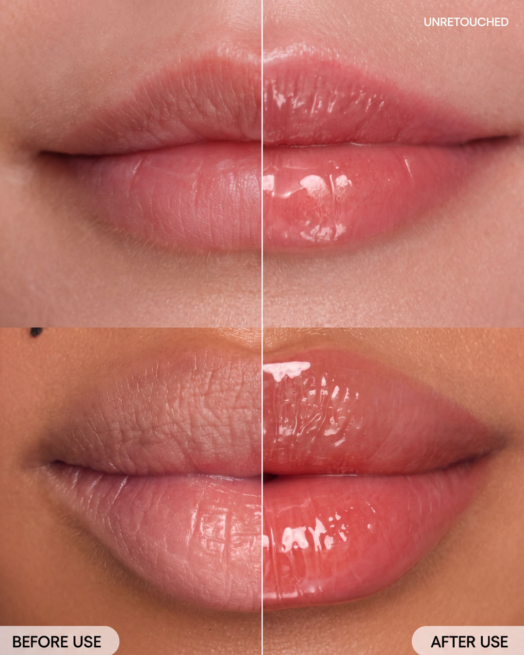 Peptide Lip Treatment
